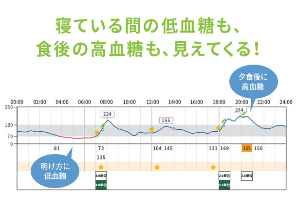 寝ている間の低血糖も、食後の高血糖も、見えてくる！