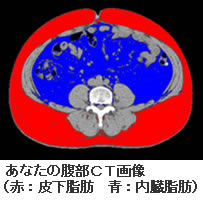 あなたの腹部CT画像