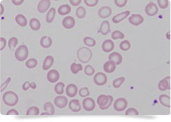 貧血症例の赤血球